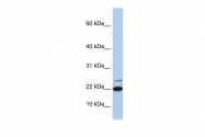 ARP54329_P050 - Interleukin-4 / IL4