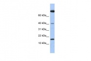 ARP54330_P050 - Interleukin-4 / IL4