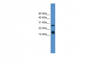 ARP54359_P050 - Interleukin-5 / IL5