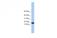 ARP54360_P050 - Interleukin-5 / IL5