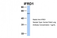ARP54585_P050 - IFRD1