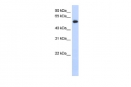 ARP54617_P050 - FRK / PTK5