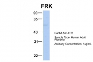 ARP54617_P050 - FRK / PTK5