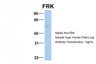 ARP54617_P050 - FRK / PTK5
