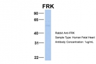 ARP54617_P050 - FRK / PTK5