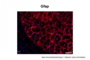 ARP54621_P050 - GFAP