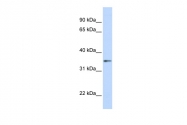 ARP54638_P050 - Transducin beta chain 1 / GNB1