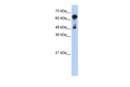 ARP54649_P050 - HSPA6