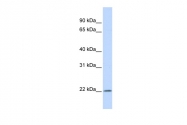 ARP54652_P050 - IFNA5 / Interferon alpha-5