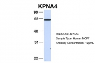 ARP54676_P050 - KPNA4 / Importin alpha-4