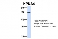 ARP54676_P050 - KPNA4 / Importin alpha-4