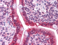 ARP54688_P050 - Galectin-3