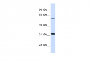 ARP54688_P050 - Galectin-3