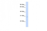 ARP54690_P050 - Leukemia inhibitory factor