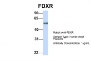 ARP54707_P050 - Ferredoxin reductase