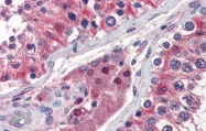 ARP54787_P050 - Isocitrate dehydrogenase / IDH