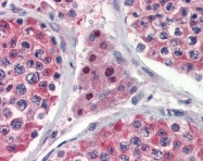ARP54787_P050 - Isocitrate dehydrogenase / IDH