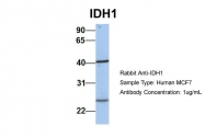 ARP54788_P050 - Isocitrate dehydrogenase / IDH
