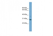 ARP54791_P050 - 14-3-3 protein sigma / SFN