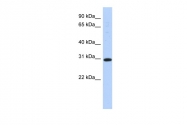 ARP54792_P050 - 14-3-3 protein sigma / SFN