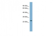 ARP54803_P050 - Glyoxalase I / GLO1