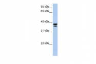 ARP54821_P050 - Galectin-9