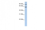 ARP54825_P050 - CCT5 / TCP1 epsilon