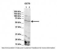 ARP54825_P050 - CCT5 / TCP1 epsilon