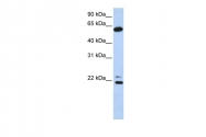ARP54826_P050 - CCT5 / TCP1 epsilon