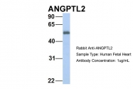 ARP54835_P050 - ANGPTL2