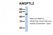 ARP54835_P050 - ANGPTL2