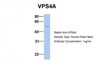 ARP54915_P050 - VPS4A