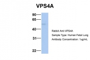 ARP54915_P050 - VPS4A