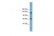 ARP54953_P050 - Isoleucyl-tRNA synthetase / IARS