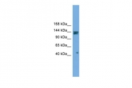 ARP54954_P050 - Isoleucyl-tRNA synthetase / IARS