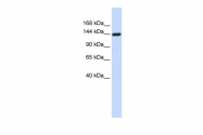 ARP55131_P050 - DAAM1