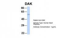 ARP55278_P050 - DAK