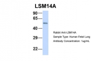 ARP55288_P050 - LSM14A