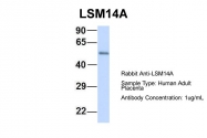 ARP55288_P050 - LSM14A