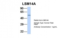 ARP55289_P050 - LSM14A
