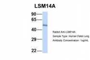 ARP55289_P050 - LSM14A