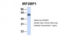 ARP55315_P050 - IRF2BP1
