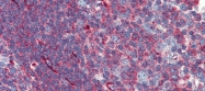 ARP55397_P050 - PHACTR1