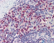 ARP55398_P050 - GABARAPL1