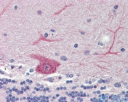 ARP55399_P050 - GABARAPL1