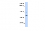 ARP55429_P050 - ALKBH3 / DEPC1
