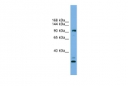 ARP55544_P050 - CCDC110