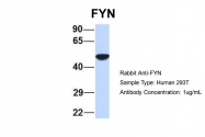 ARP55567_P050 - FYN