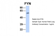 ARP55567_P050 - FYN