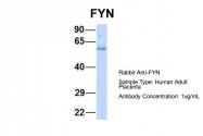 ARP55567_P050 - FYN